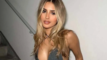 Julieta Poggio sufrió un accidente en un barco: cómo le quedó la cara.