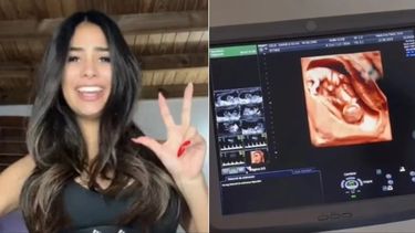 La ex Gran Hermano Daniela Celis dijo podría tener trillizos en lugar de gemelos