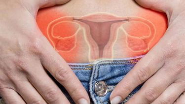 Hoy es el Día Mundial del Cáncer de Ovario.
