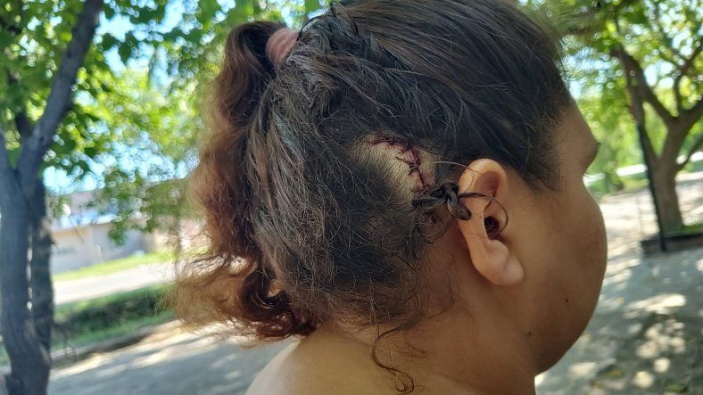 Así quedó la cabeza de una de las víctimas.&nbsp;