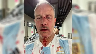 Uno de los dos hinchas argentinos agredidos.