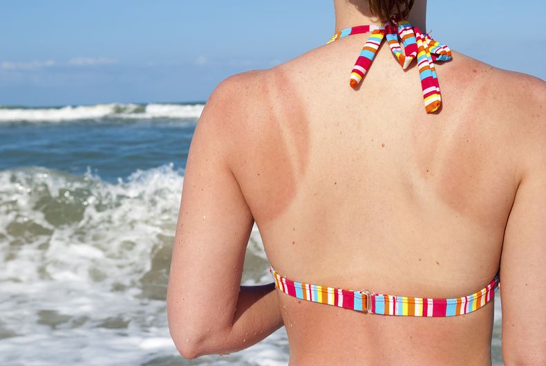 Consejos para cuidar a la piel del sol durante las vacaciones.