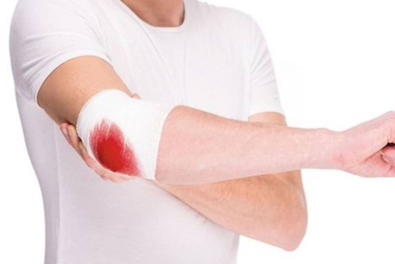 Día Mundial de la Hemofilia: por qué se celebra hoy, 17 de abril