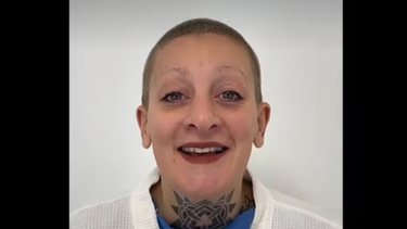 Así luce Furia Scaglione de Gran Hermano tras recuperarse de su cirugía estética: ¿qué te parece el cambio?