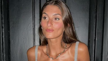 Lola Latorre se sometió a una rinoplastía y reflexionó sobre la belleza y el amor propio