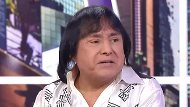 ¡Irreconocible!: revuelo en redes después de ver cómo quedó Ricky Maravilla tras una cirugía estética