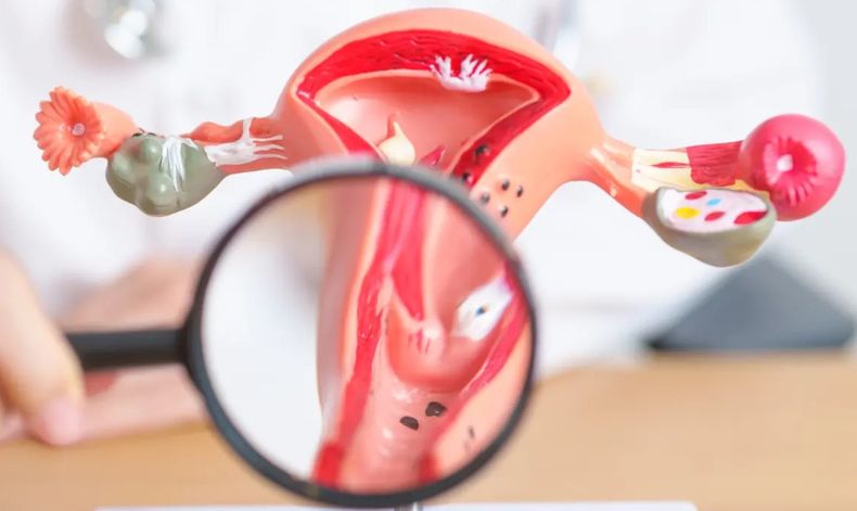 Este 26 de marzo se celebró el Día Mundial de la Prevención de Cáncer de Cuello Uterino (Foto gentileza).