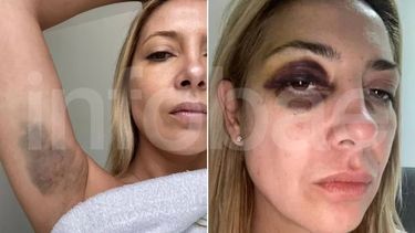 aparecieron las fotos de fabiola yanez golpeada y los chats con alberto
