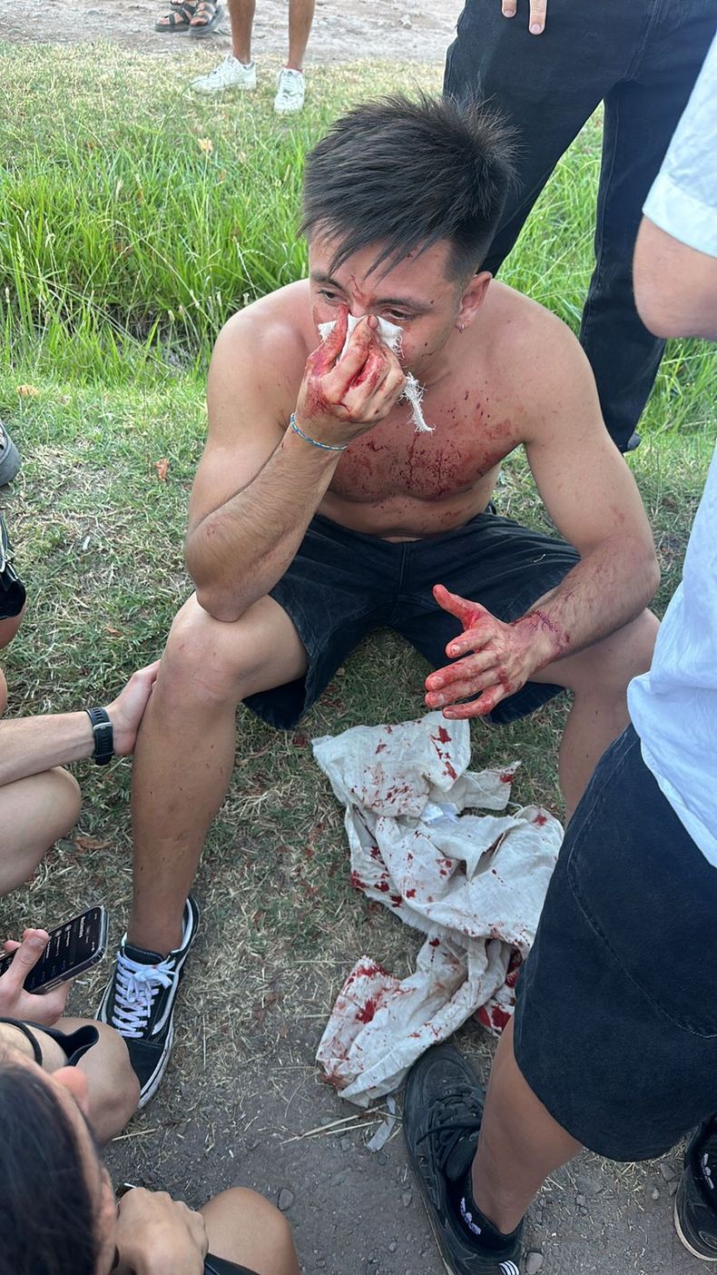 La víctima de 24 años, logró identificar a tres de los 5 sujetos que lo golpearon a la salida de una fiesta en Luján de Cuyo. 
