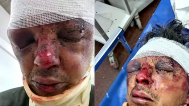 San Carlos, feroz golpiza a hombre de 44 años de Chilecito.