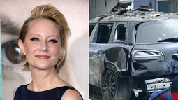Anne Heche pelea por su vida.