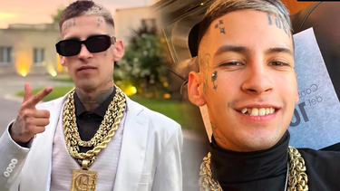 El radical cambio de L-Gante con su nueva dentadura.