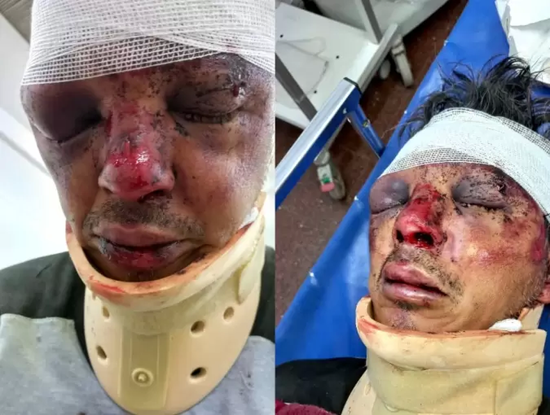 San Carlos, feroz golpiza a hombre de 44 años de Chilecito.