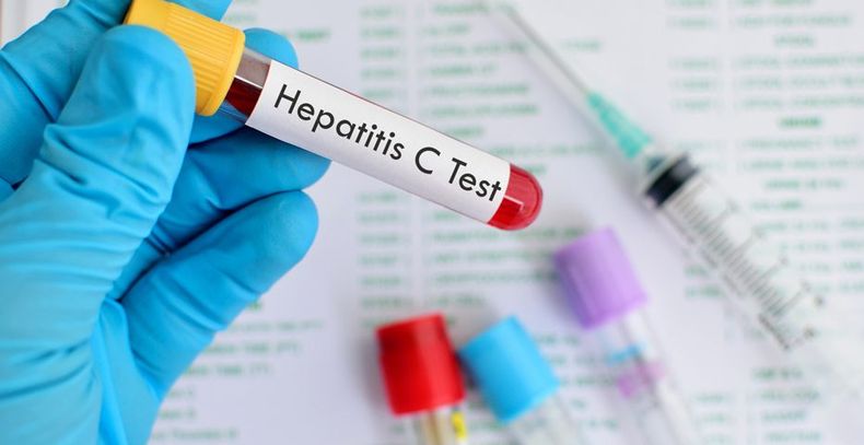 Según la OMS, actualmente 11 millones de personas en todo el mundo ya fueron diagnosticadas con hepatitis C.