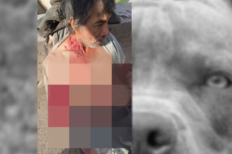 Brutal ataque de dos perros al trabajador de un galpón en Las Heras.&nbsp;