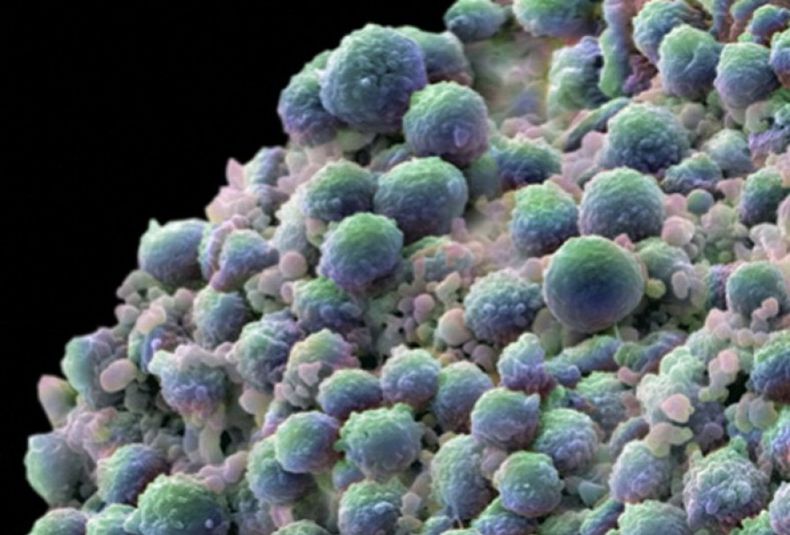Cancer resize
