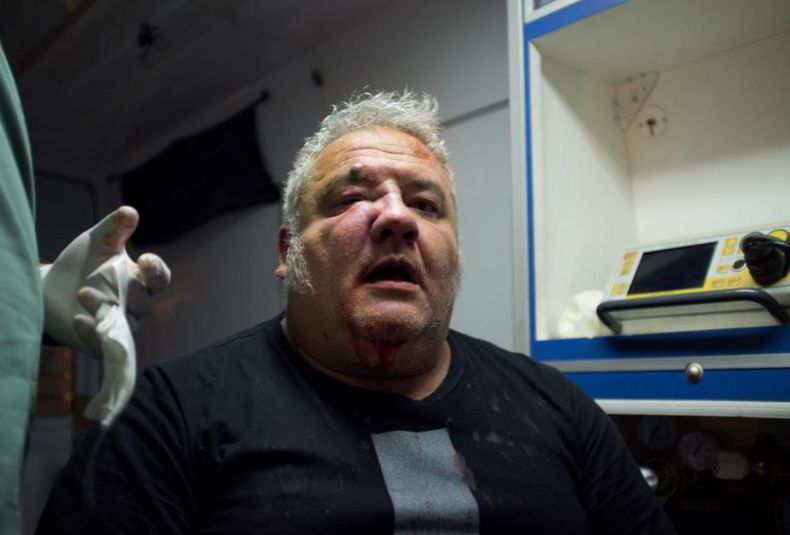 César Cambas, agresión