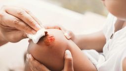 Día Mundial de la Hemofilia: por qué se celebra hoy, 17 de abril